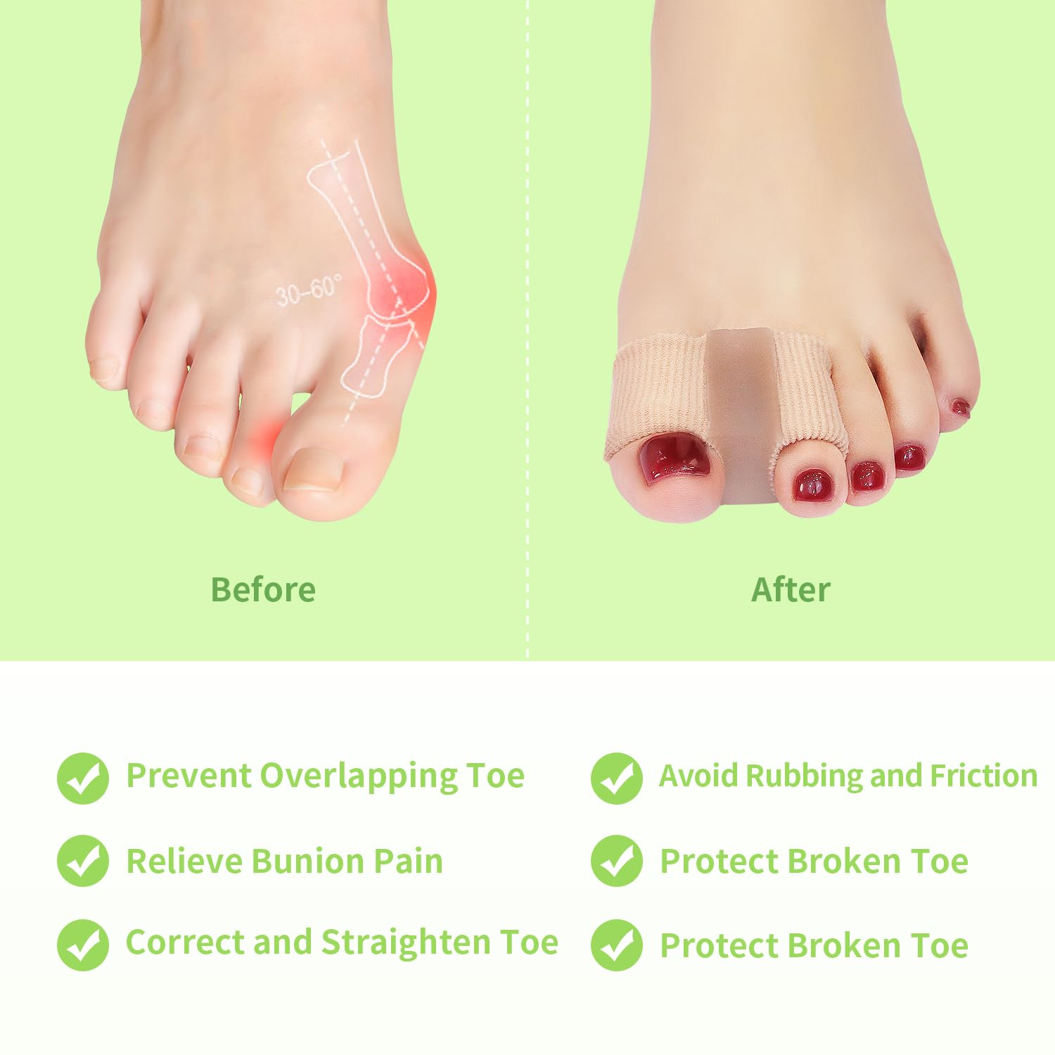 4-Pack Gel Bunion Toe Separators with Protectors, Soft Silicone Toe Spacers for Overlapping Toes, Blisters, Calluses and Foot Comfort